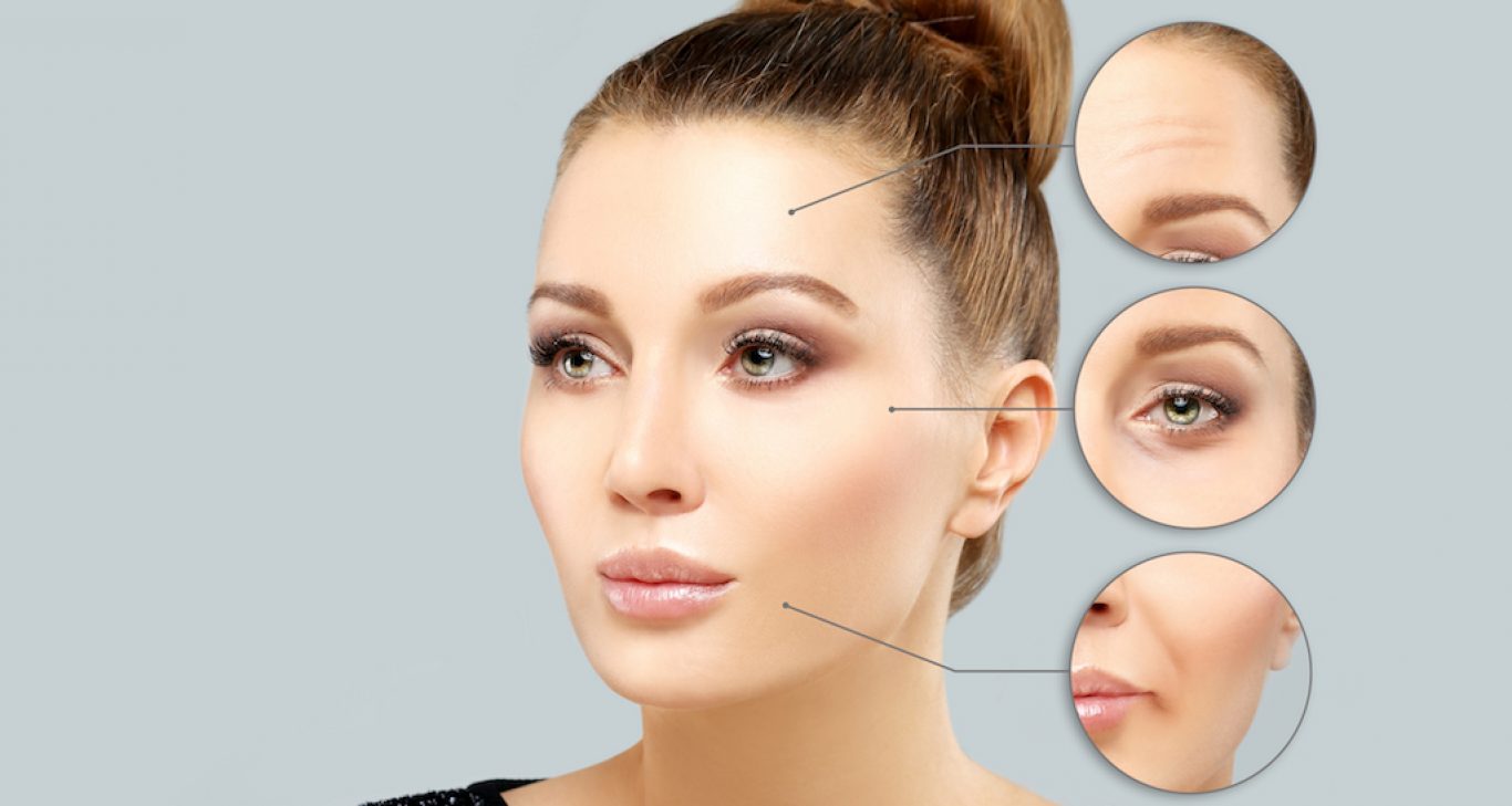 What is blepharoplasty Santa Barbara? post thumbnail image