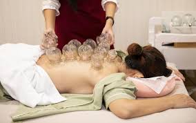 The therapy of Cupping Singapore that promotes blood circulation post thumbnail image