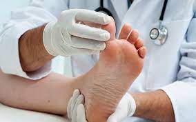 Professional Foot care Solutions in Nassau County post thumbnail image